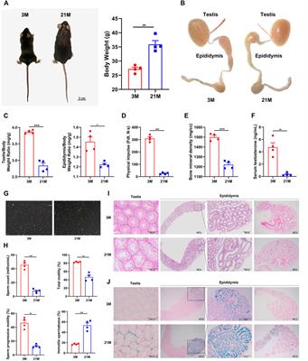 Anatomical Transcriptome Atlas of the Male Mouse Reproductive System During Aging